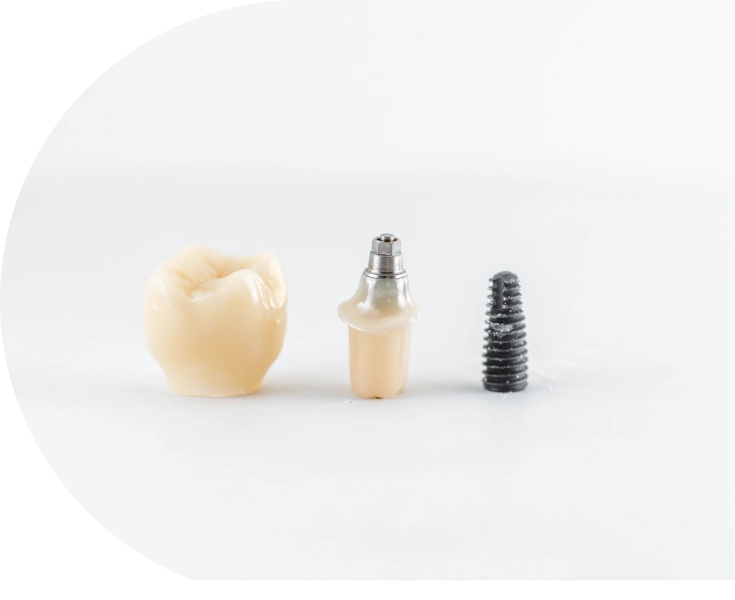 Corona, pilar y tornillo de un implante dental