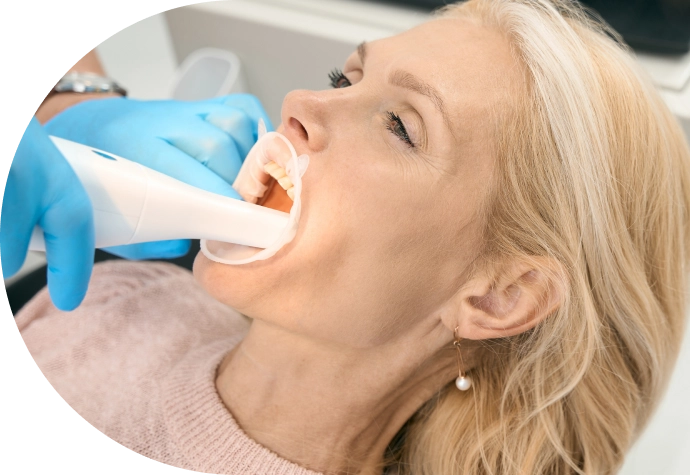 Coronas y puentes utilizados en una rehabilitación dental
