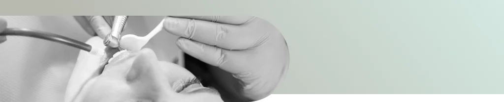 Tratamiento de endodoncia en Barberá del Vallés