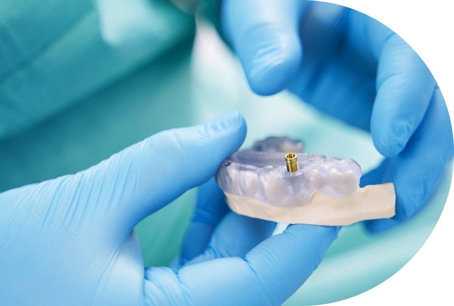 Planificación de un implante dental sobre un modelo