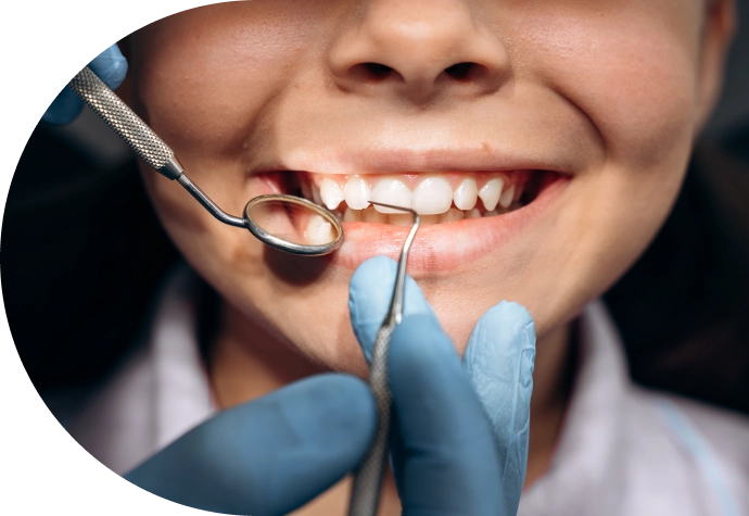 Revisión dental infantil realizada por un odontopediatra